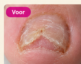 Voorbeeld van een nagel voor een nagelreconstructie